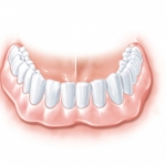 implant friadent warszawa