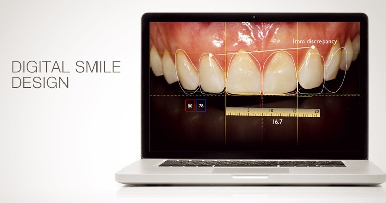 Digital Smile Design, czyli projektowanie zdrowego i pięknego uśmiechu