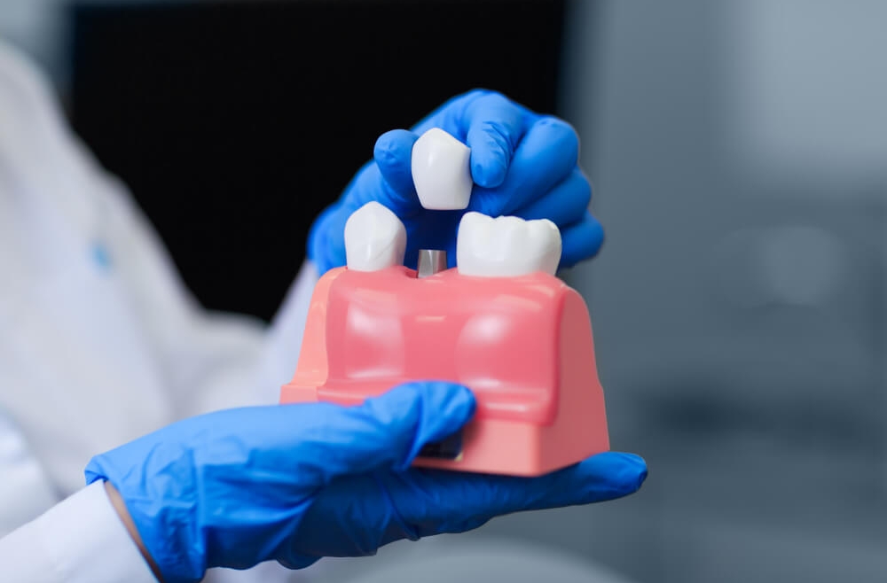 Implanty jako skuteczna metoda leczenia dla osób z wrodzonym brakiem zębów