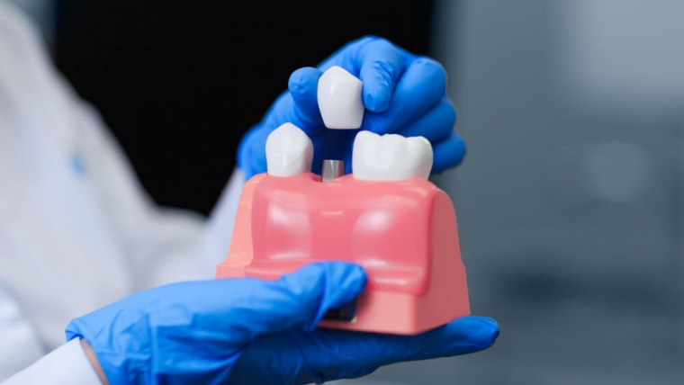 Implanty jako skuteczna metoda leczenia dla osób z wrodzonym brakiem zębów