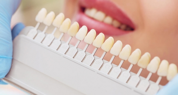 Jak osiągnąć naturalne efekty wybielania zębów?