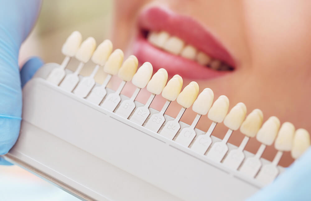 Jak osiągnąć naturalne efekty wybielania zębów?