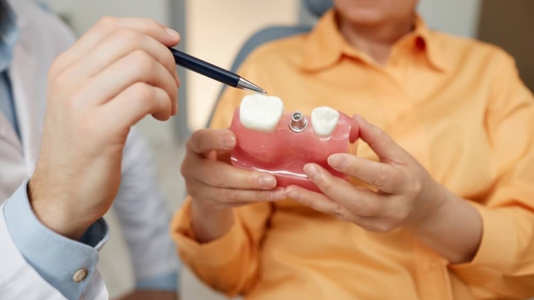 Implanty zębowe – dlaczego są tak drogie?