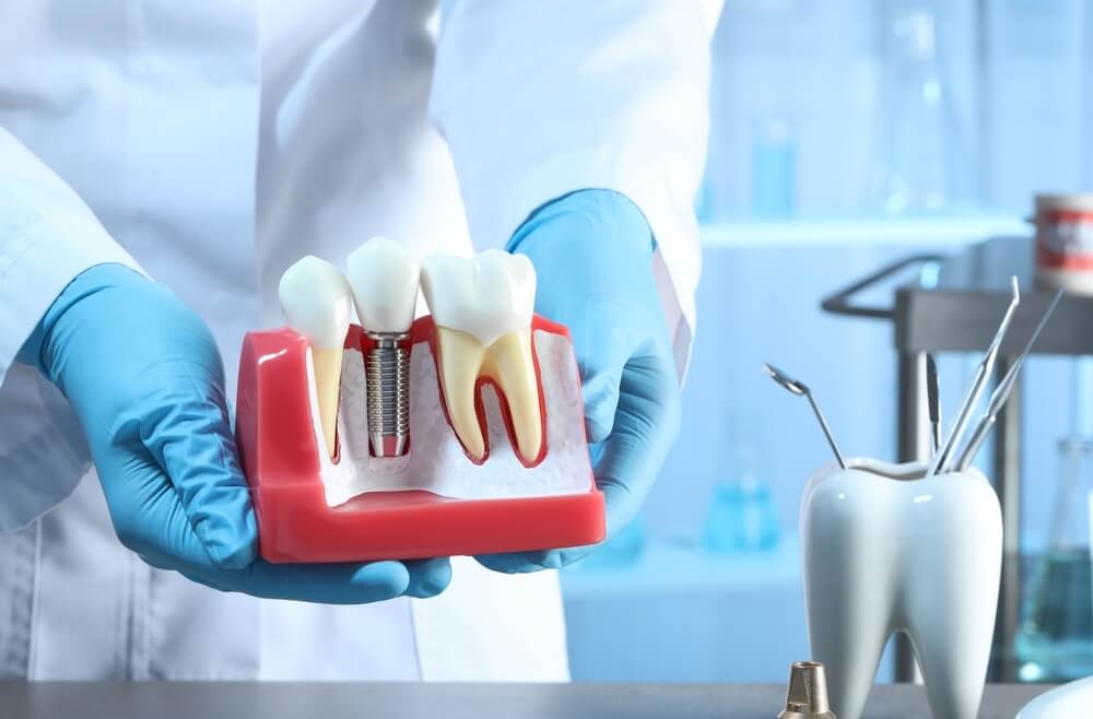 Nowoczesna implantologia stomatologiczna – technologie, które zmieniają leczenie
