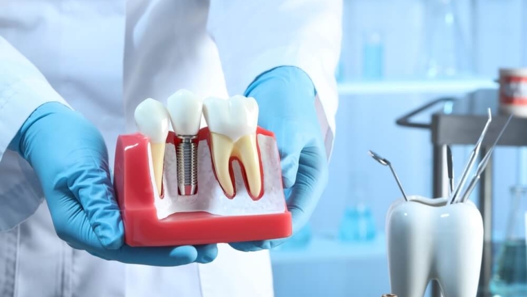 Nowoczesna implantologia stomatologiczna – technologie, które zmieniają leczenie