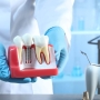 Nowoczesna implantologia stomatologiczna – technologie, które zmieniają leczenie
